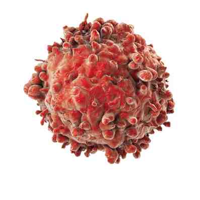 Oncology